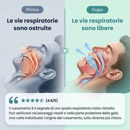 RinovaX™ – Bite orale anti-russamento medicale, discreto e confortevole