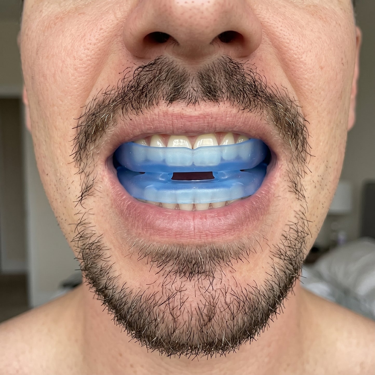 RinovaX™ – Bite orale anti-russamento medicale, discreto e confortevole