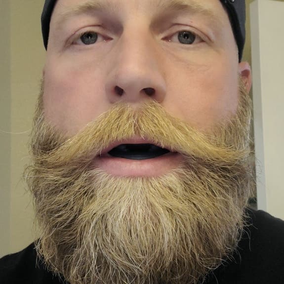 RinovaX™ – Férula antirronquidos silenciosa universal